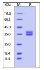 Mouse FOLR1, His Tag on SDS-PAGE under reducing (R) condition. The gel was stained overnight with Coomassie Blue. The purity of the protein is greater than 95%.